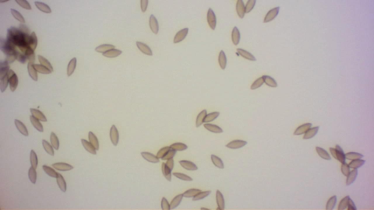 Microscopy of brown, oblong, apiculate Cocoicola californica spores at high magnification